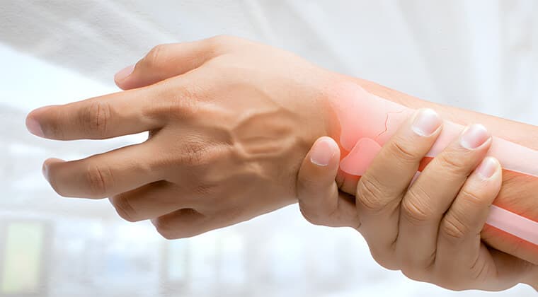 Fractura de muñeca