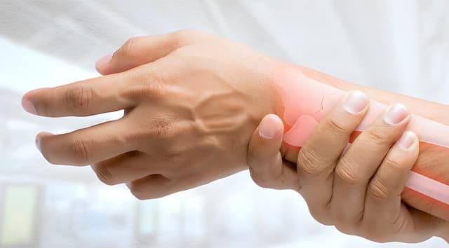 Fractura de muñeca